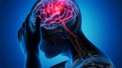 beyin cerrahi ve sinir hastalıkları neye bakar